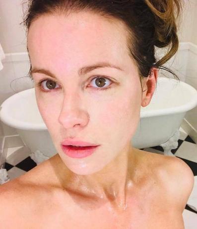 Yli 40-vuotiaiden julkkisten iho: Kate Beckinsale